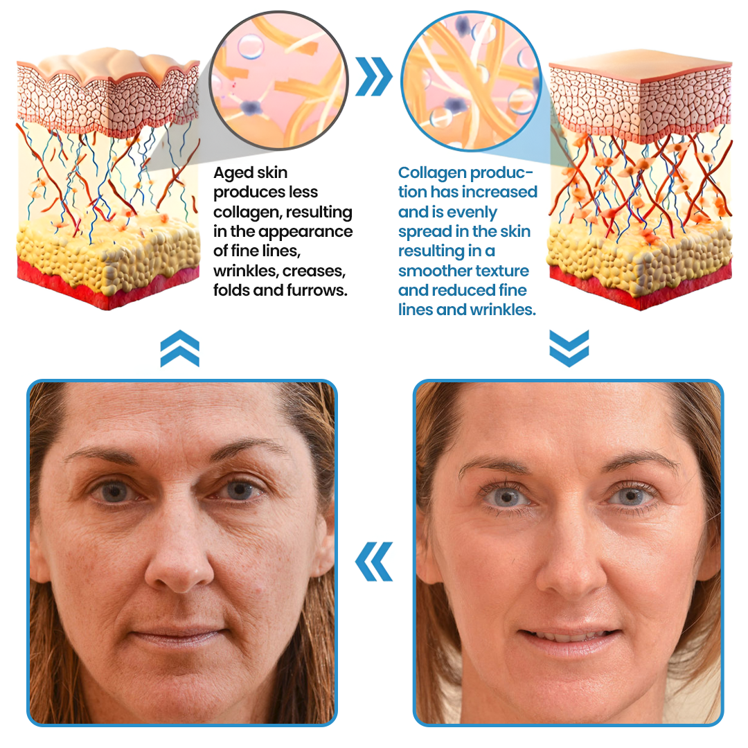 Biancat® Collagen Peptide Serum