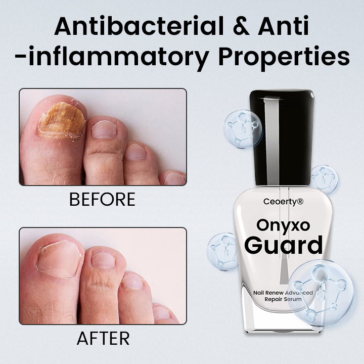 Ceoerty® OnyxoGuard Nail Renew Advanced Repair Serum ❤️
