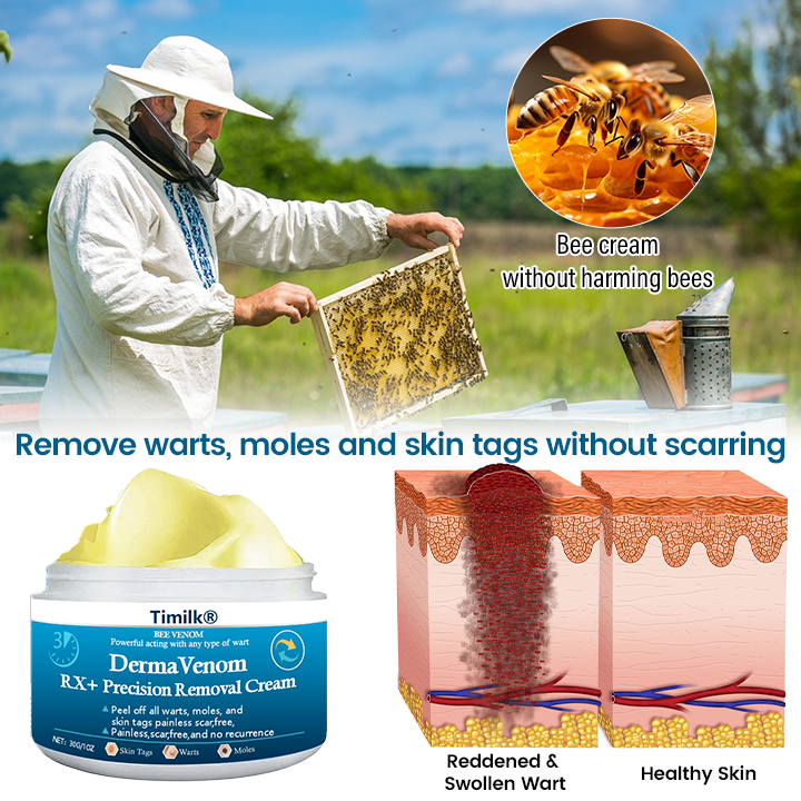 Timilk® DermaVenom RX+ Precision Removal Cream ❤️
