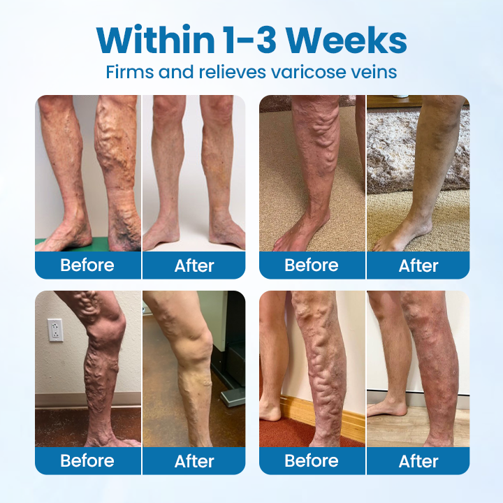 Timilk® VeinGuard Herbal Spray