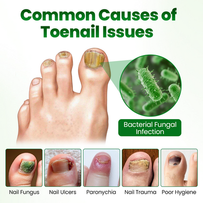 Timilk® HerbaNail 7-Day Repair Serum 🇦🇺