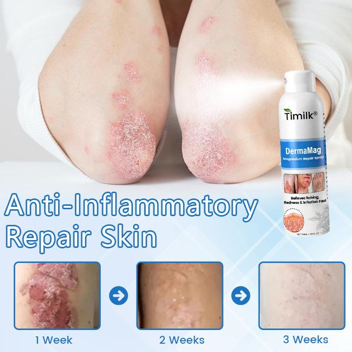 Timilk® DermaMag Magnesium Repair Spray✨