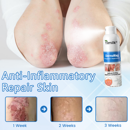 Timilk® DermaMag Magnesium Repair Spray✨