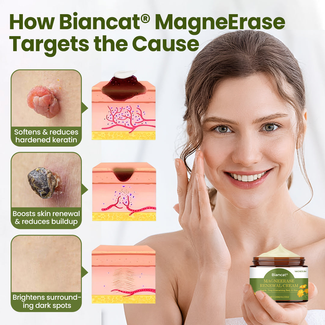 Biancat® MagneErase Renewal Cream 🇦🇺