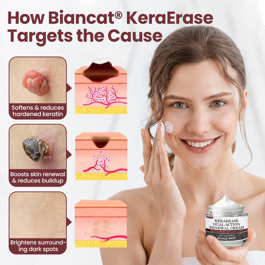 Biancat® KeraErase Dual-Action Renewal Cream🔥