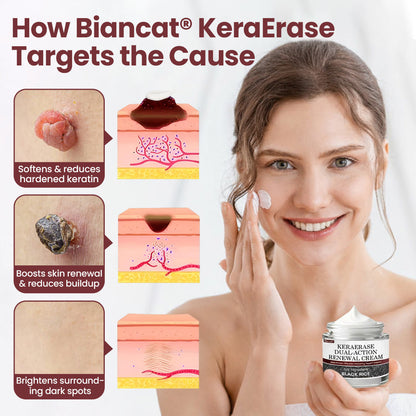 Biancat® KeraErase Dual-Action Renewal Cream🔥