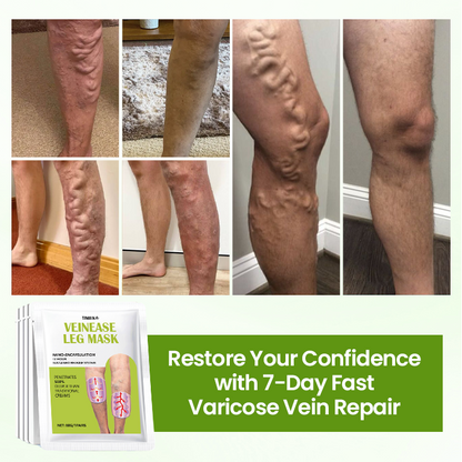 Timilk®VeinEase Leg Mask✨