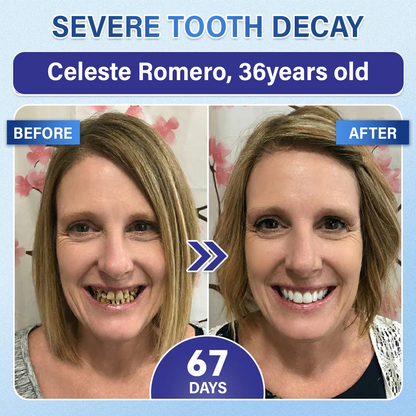 Ceoerty® Tooth & Gum Repair Fast-Dissolving Microneedle Patch❤️
