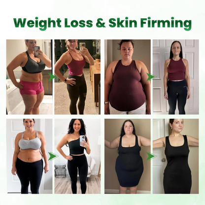 Timilk® SculptAura Moringa • Berberin + NAD+ 10-in-1 Nano-Microneedle-Patch