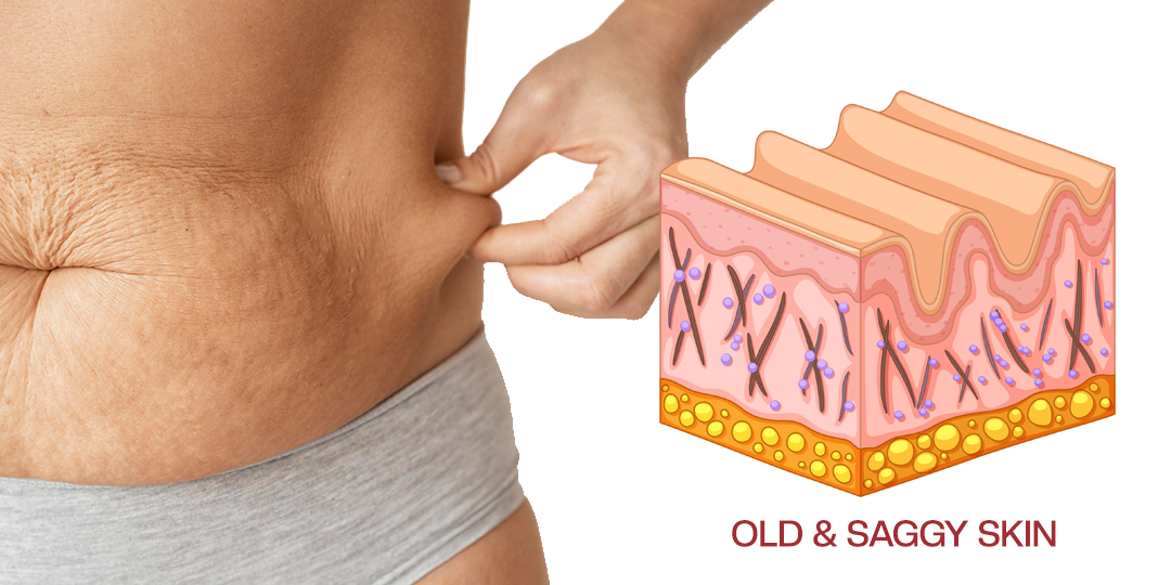 Timilk® AuréLuxe Body Firming Oil 🇦🇺