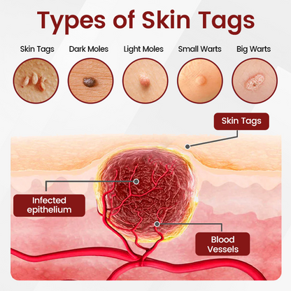 Ceoerty® KeraErase Black Rice Renewal Ampoule