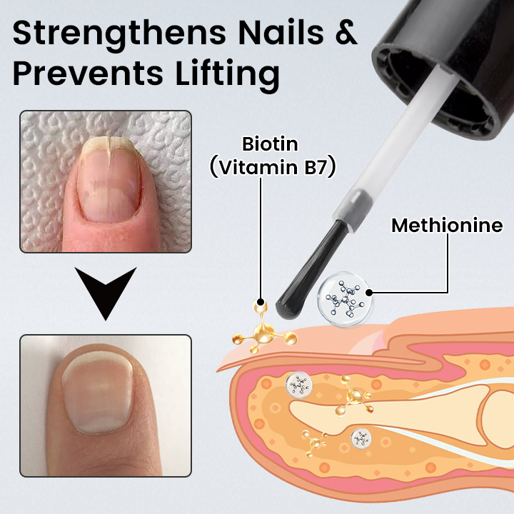 Ceoerty® OnyxoGuard Nail Renew Advanced Repair Serum ❤️