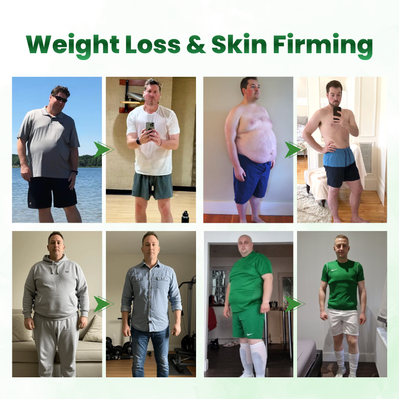 Timilk® SculptAura Moringa • Berberin + NAD+ 10-in-1 Nano-Microneedle-Patch