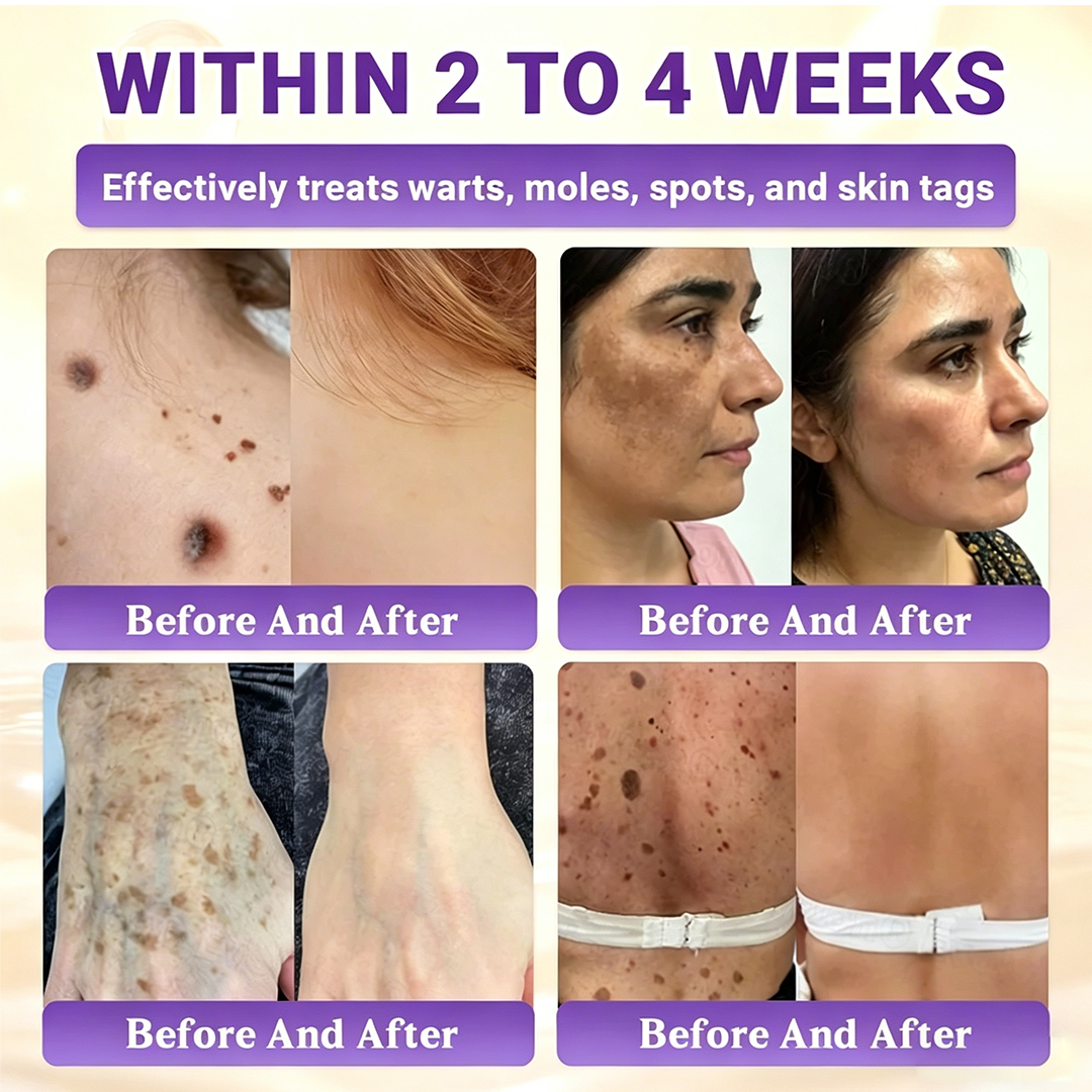 Timilk® BioColla DermaRenew Cream（au）