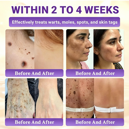 Timilk® BioColla DermaRenew Cream（au）