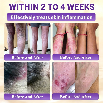 Timilk® BioColla DermaRenew Cream（au）
