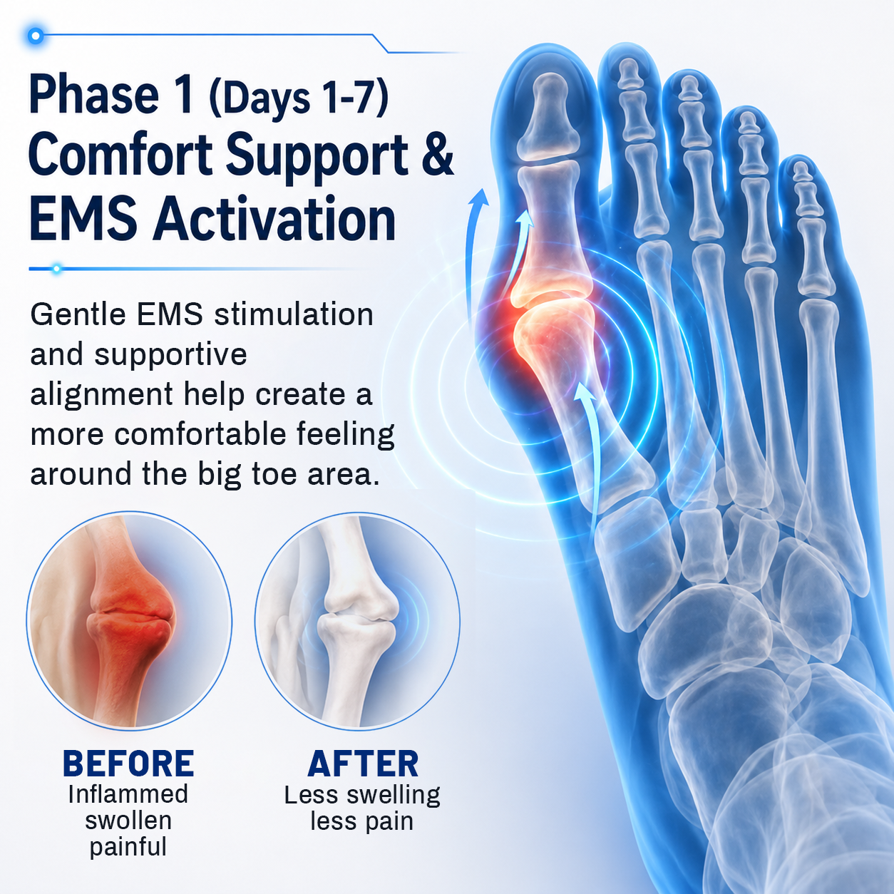 Bikenda® FootAlign EMS Pro —— Advanced EMS Foot Support System