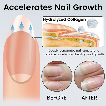 Ceoerty® OnyxoGuard Nail Renew Advanced Repair Serum ❤️
