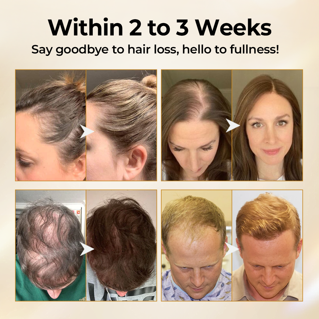 Timilk® CollagenGrow Peptides Hair Growth Spray