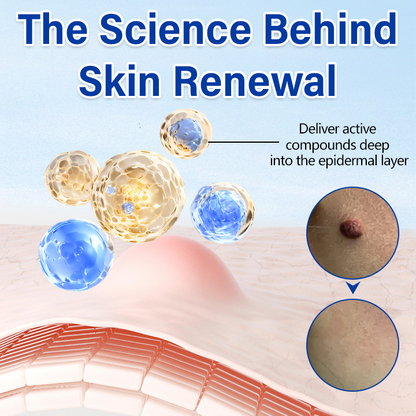 Timilk® WartClear Herbal Ointment