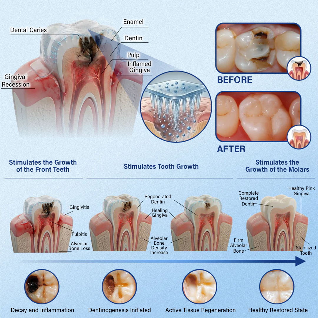 Ceoerty® Tooth & Gum Repair Fast-Dissolving Microneedle Patch❤️
