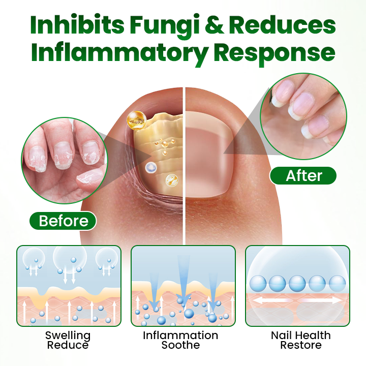 Timilk® HerbaNail 7-Day Repair Serum 🇦🇺