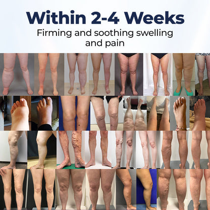 Timilk® SwellRelief Circulation Support Cream