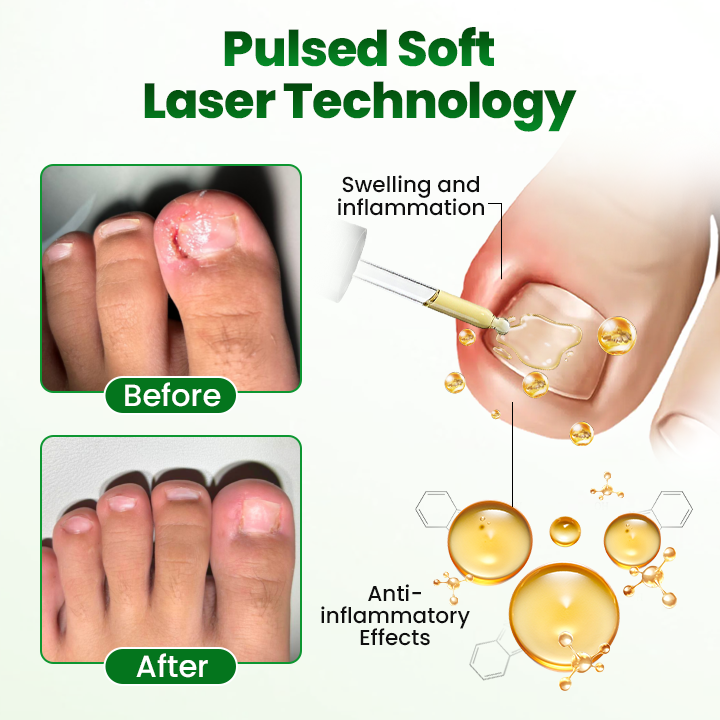 Timilk® HerbaNail 7-Day Repair Serum 🇦🇺