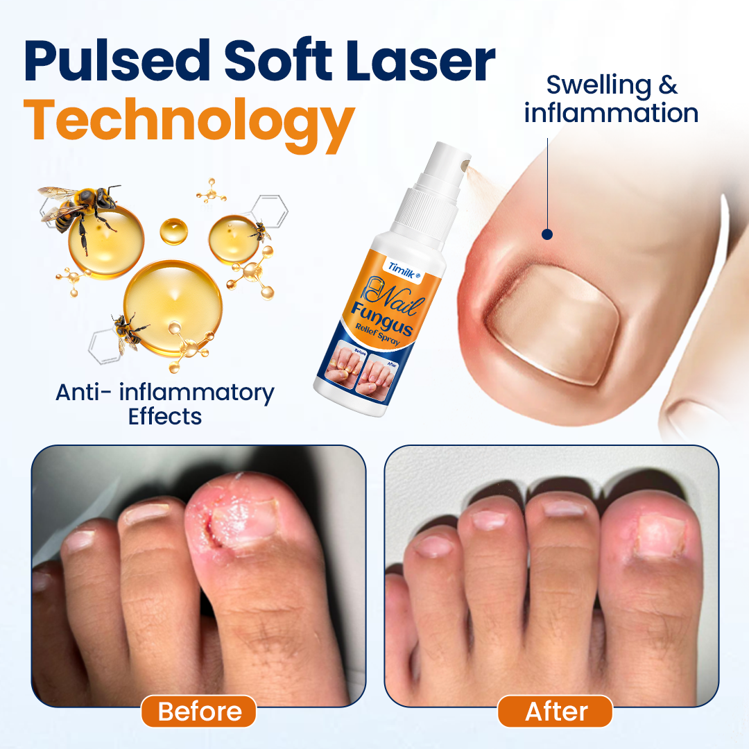 Timilk® Nail fungus relief spray
