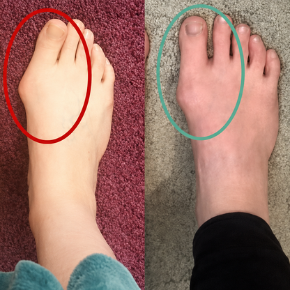 Bikenda® FootAlign EMS Pro —— Advanced EMS Foot Support System