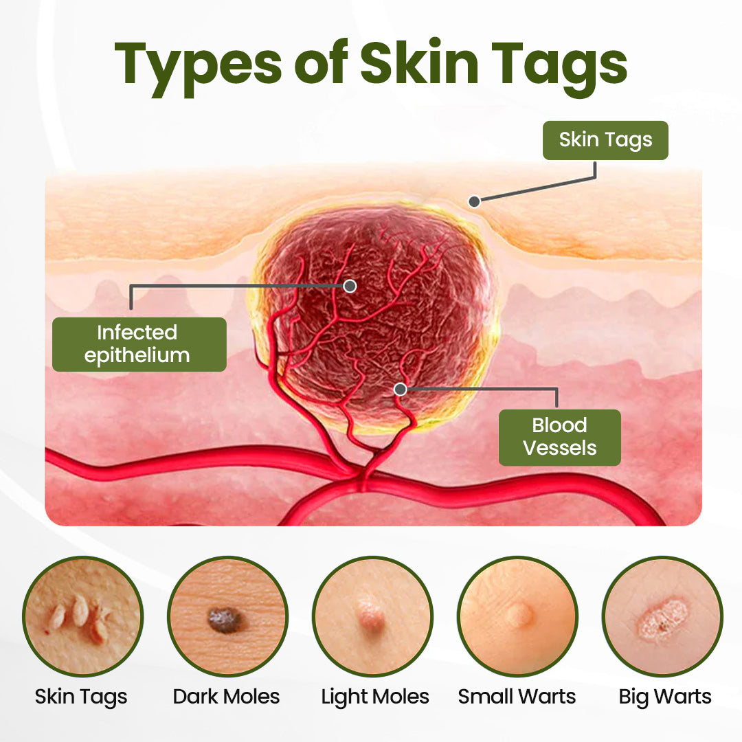 Biancat® MagneErase Renewal Cream 🇦🇺