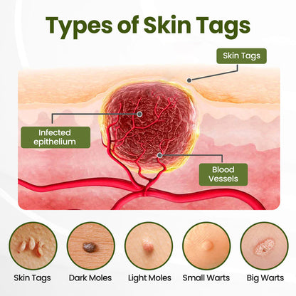 Biancat® MagneErase Renewal Cream 🇦🇺