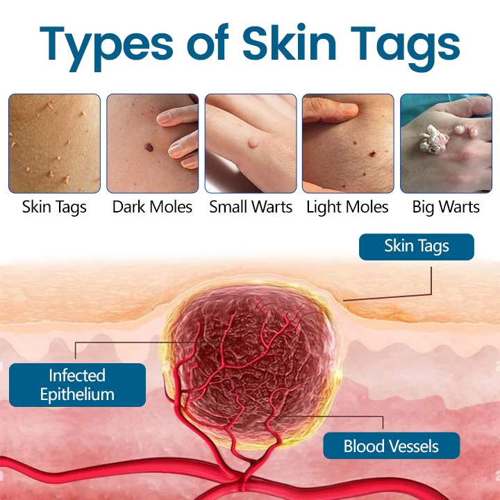 Timilk® DermaVenom RX+ Precision Removal Cream ❤️