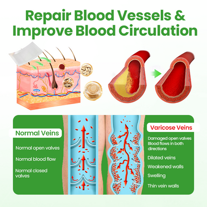Healrize® VeinHeal Microneedle Patch ❤️