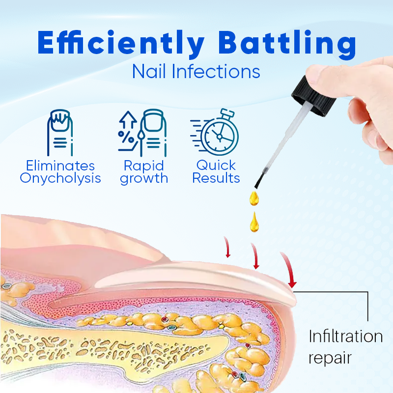 Biancat® OnyxoGuard Nail Growth and Repair Serum🎂