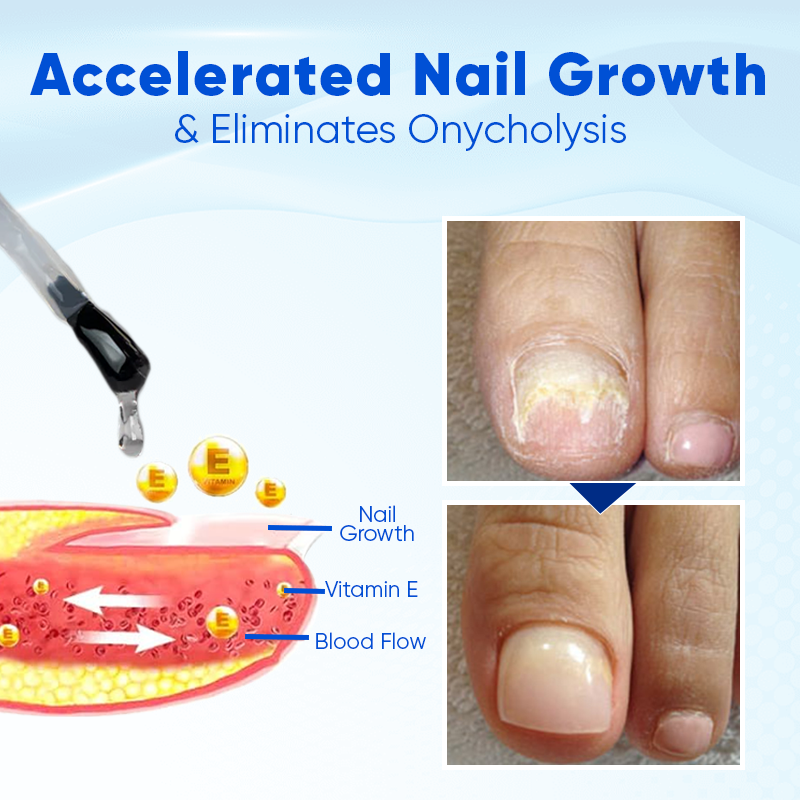 Biancat® OnyxoGuard Nail Growth and Repair Serum🎂