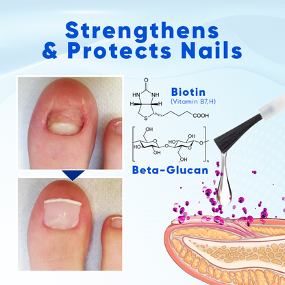 Biancat® OnyxoGuard Nail Growth and Repair Serum🎂