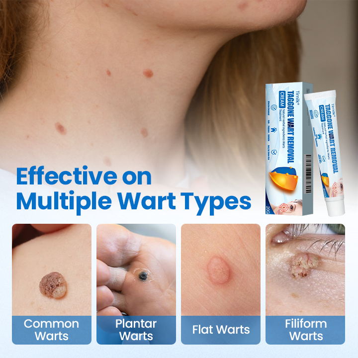 Timilk® TagGone Wart Removal Cream 🎁